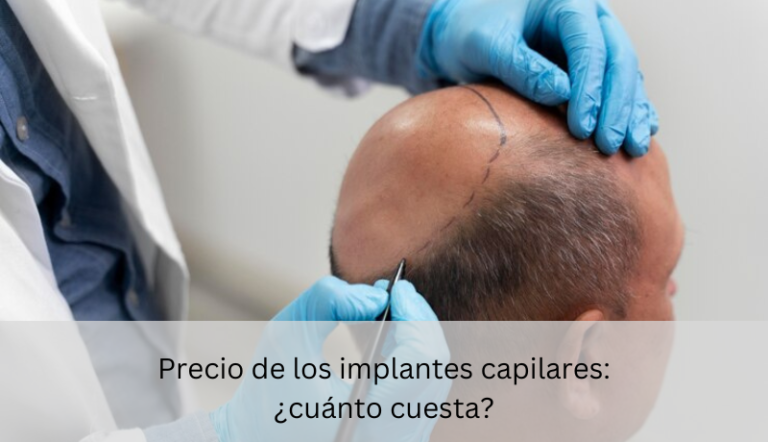 cuanto cuesta implante de cabello